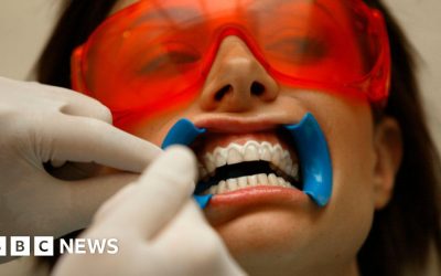 BBC investigation exposes dangerous teeth-whitening industry